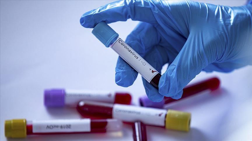 Srbija: Preminulo još 19 osoba, 1.646 novozaraženih